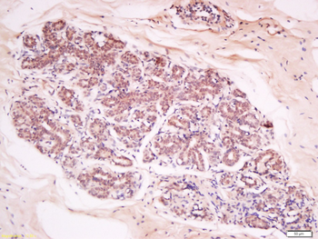 Phospho-AKT (Ser473) Rabbit Polyclonal Antibody
