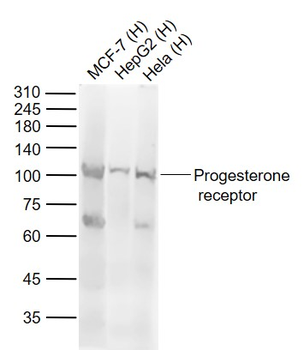 Progesterone receptor Rabbit Polyclonal Antibody