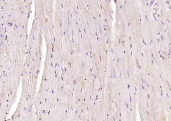 PHD3 Rabbit Polyclonal Antibody