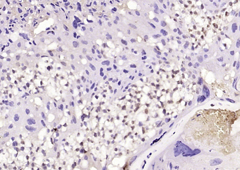 PHD3 Rabbit Polyclonal Antibody