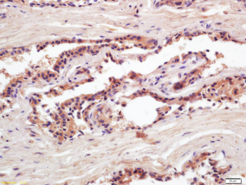 PSA Mouse Monoclonal Antibody