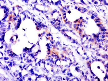 PSCA Rabbit Polyclonal Antibody