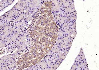 PSMD9 Rabbit Polyclonal Antibody