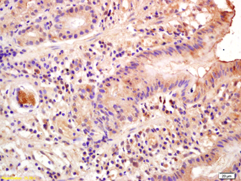 PTEN Rabbit Polyclonal Antibody