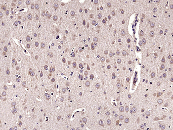 Parvalbumin Rabbit Polyclonal Antibody