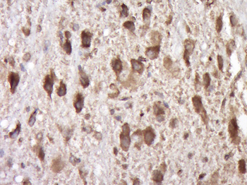 SCF Rabbit Polyclonal Antibody