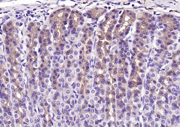 SFRP1 Rabbit Polyclonal Antibody