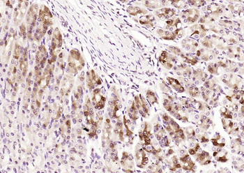 Shh Rabbit Polyclonal Antibody
