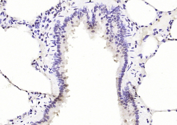PTPN6 Rabbit Polyclonal Antibody