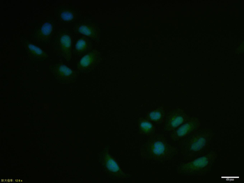 SKP2 Rabbit Polyclonal Antibody