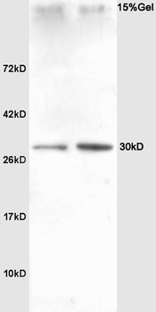 SNAI2 Rabbit Polyclonal Antibody