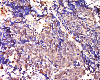 SNAI2 Rabbit Polyclonal Antibody