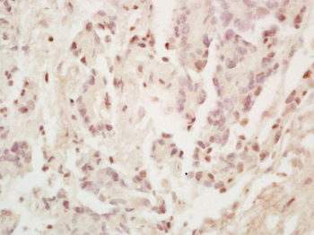 SP1 Rabbit Polyclonal Antibody