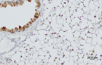 SFTPA1 Rabbit Polyclonal Antibody