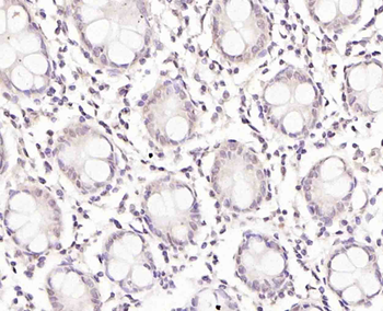TRIM21 Rabbit Polyclonal Antibody
