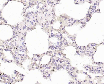 TRIM21 Rabbit Polyclonal Antibody