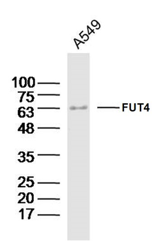FUT4 Rabbit Polyclonal Antibody