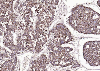 SYVN1 Rabbit Polyclonal Antibody