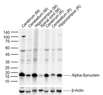 Alpha-Synuclein Rabbit Polyclonal Antibody