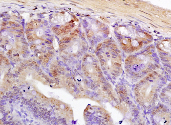 TCF7L2 Rabbit Polyclonal Antibody