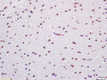 TARDBP Rabbit Polyclonal Antibody