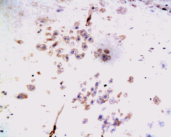 TFPI-2 Rabbit Polyclonal Antibody