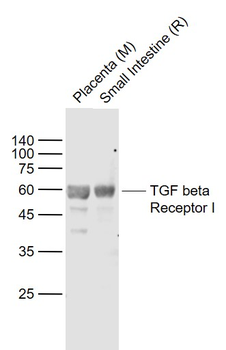 TGF beta Receptor I Rabbit Polyclonal Antibody