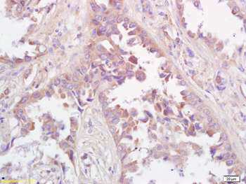 DNAJC10 Rabbit Polyclonal Antibody