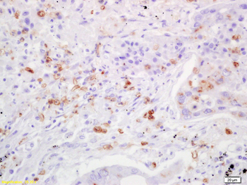 TIMP-3 Rabbit Polyclonal Antibody