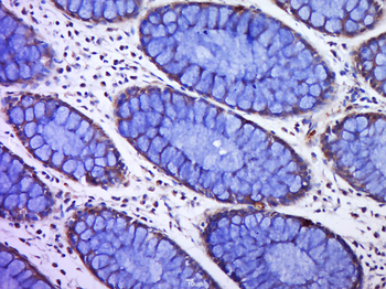 C12ORF42 Rabbit Polyclonal Antibody