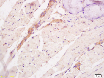 Tenascin C Rabbit Polyclonal Antibody