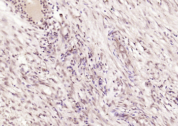 P53 (Acetyl K382) Rabbit Polyclonal Antibody
