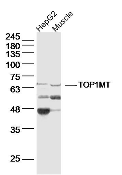 TOP1MT Rabbit Polyclonal Antibody