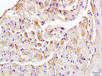 TOP1MT Rabbit Polyclonal Antibody