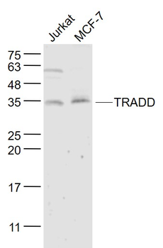 TRADD Rabbit Polyclonal Antibody