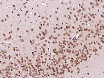 TRF1 Rabbit Polyclonal Antibody