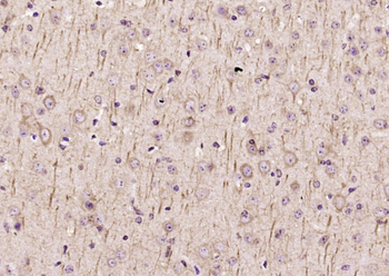 TRIM32 Rabbit Polyclonal Antibody