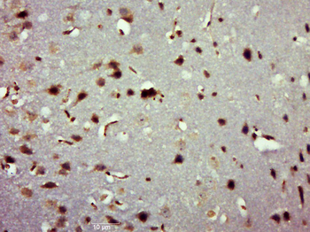 Trk A + B + C Rabbit Polyclonal Antibody