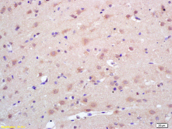 Trk A + B + C Rabbit Polyclonal Antibody