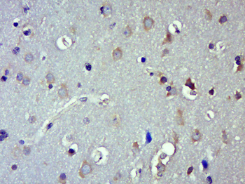 TrkB Rabbit Polyclonal Antibody