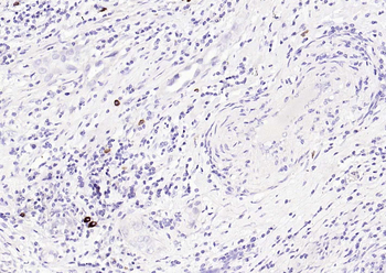 HPV16 E6 Rabbit Polyclonal Antibody