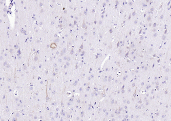 Phospho-PLCG1 (Tyr775) Rabbit Polyclonal Antibody
