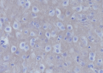 SNAP25 Recombinant Mouse Monoclonal Antibody
