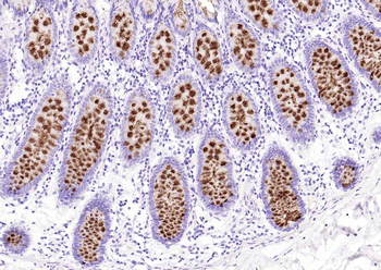 MUC2 Recombinant Rabbit Monoclonal Antibody