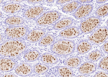MUC2 Recombinant Rabbit Monoclonal Antibody