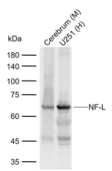 NF-L Rabbit Polyclonal Antibody