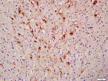 NF-L Rabbit Polyclonal Antibody