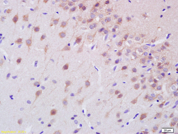 NF-L Rabbit Polyclonal Antibody