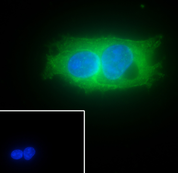 Glypican 3 Recombinant Rabbit Monoclonal Antibody
