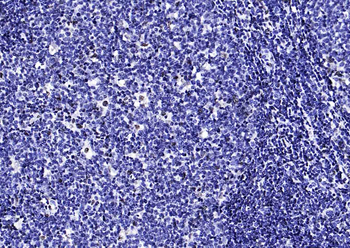PML Rabbit Polyclonal Antibody